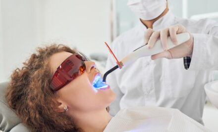 How Effective is Professional Teeth Whitening from a Dentist?