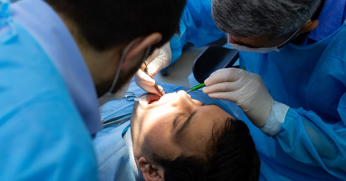 Overdentures vs Implants: Let’s Break it Down for You